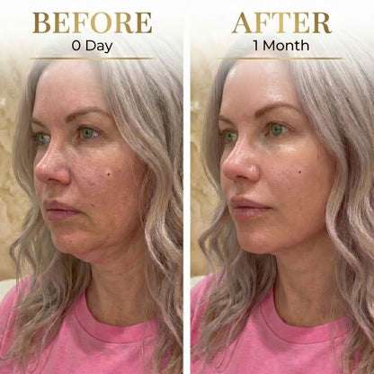 AYA™ Lymphdrainage-Gesichtsbürste